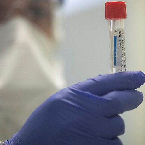 Este miércoles se registraron 158 nuevos casos de coronavirus en Entre Ríos Este miércoles se registraron 158 nuevos casos de coronavirus en Entre Ríos