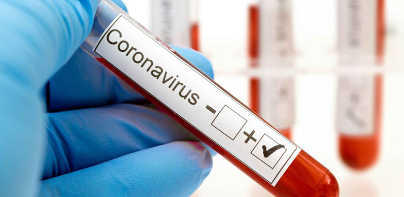 Este lunes se registraron 105 nuevos casos de coronavirus en Entre Ríos
