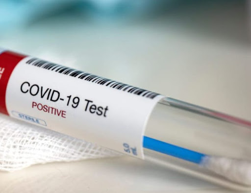 Este jueves se registraron 196 nuevos casos de coronavirus en Entre Ríos Este jueves se registraron 196 nuevos casos de coronavirus en Entre Ríos