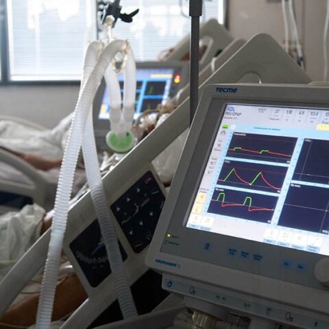 Murieron 158 personas y 6.141 fueron reportadas con coronavirus en las últimas 24 horas Murieron 158 personas y 6.141 fueron reportadas con coronavirus en las últimas 24 horas