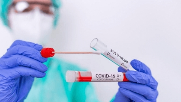 En las últimas 24 horas hubo 43 muertes y 2.234 contagiados de coronavirus en Argentina En las últimas 24 horas hubo 43 muertes y 2.234 contagiados de coronavirus en Argentina