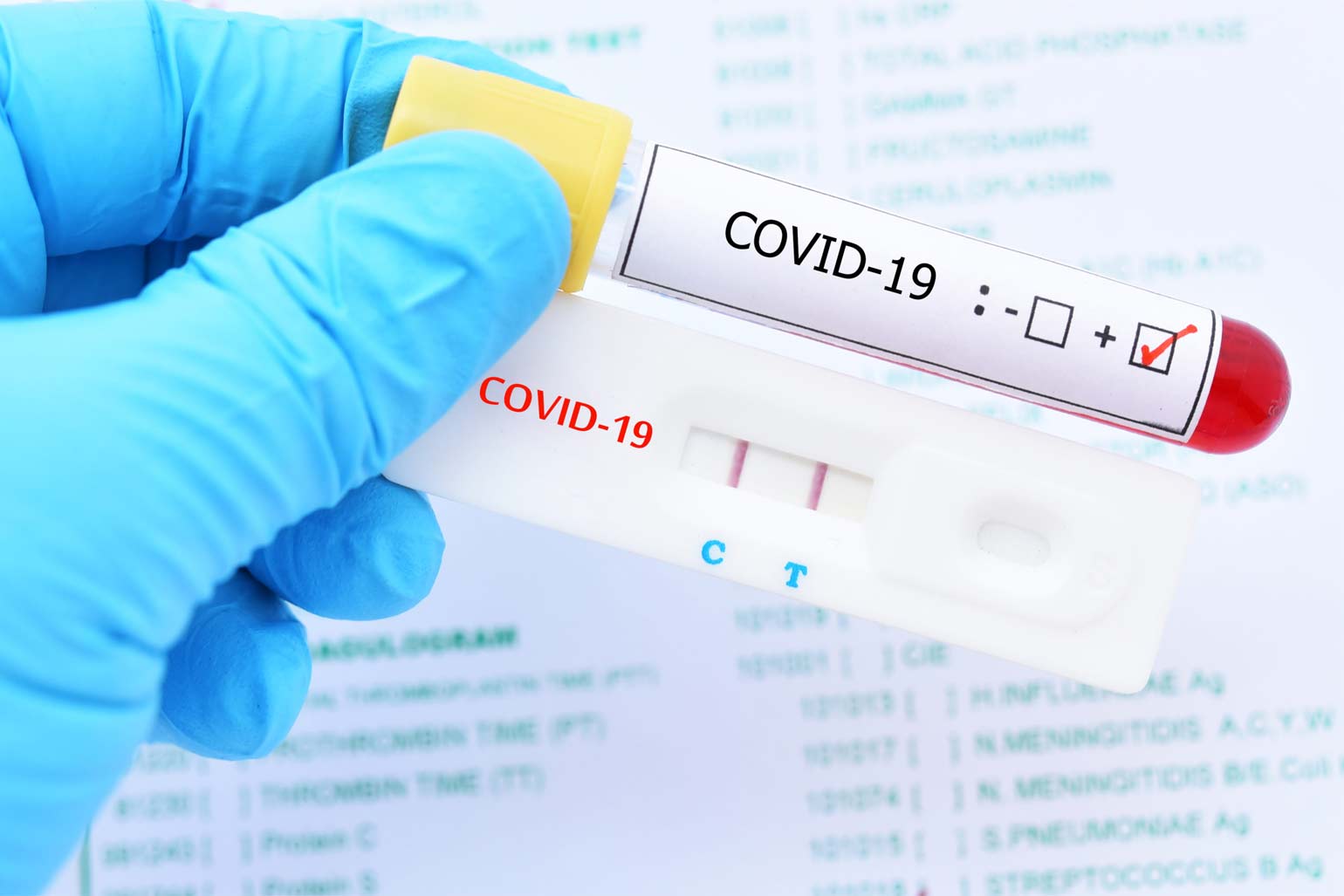 Los casos de coronavirus aumentaron 92 % en una semana en el país Los casos de coronavirus aumentaron 92 % en una semana en el país