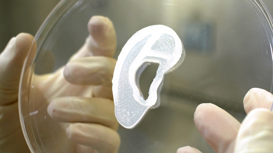Trasplantan por primera vez una oreja impresa en 3D con células humanas Trasplantan por primera vez una oreja impresa en 3D con células humanas