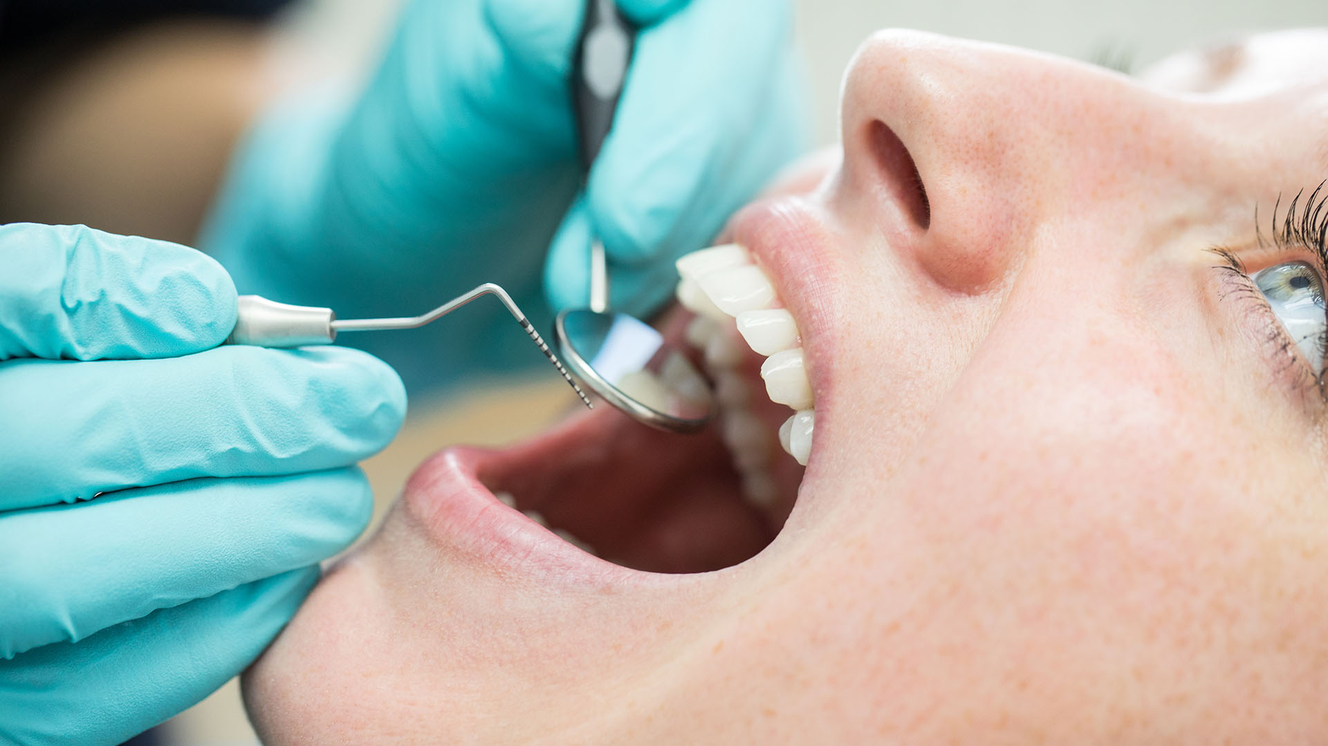 De qué forma una mala alimentación puede afectar a los dientes De qué forma una mala alimentación puede afectar a los dientes