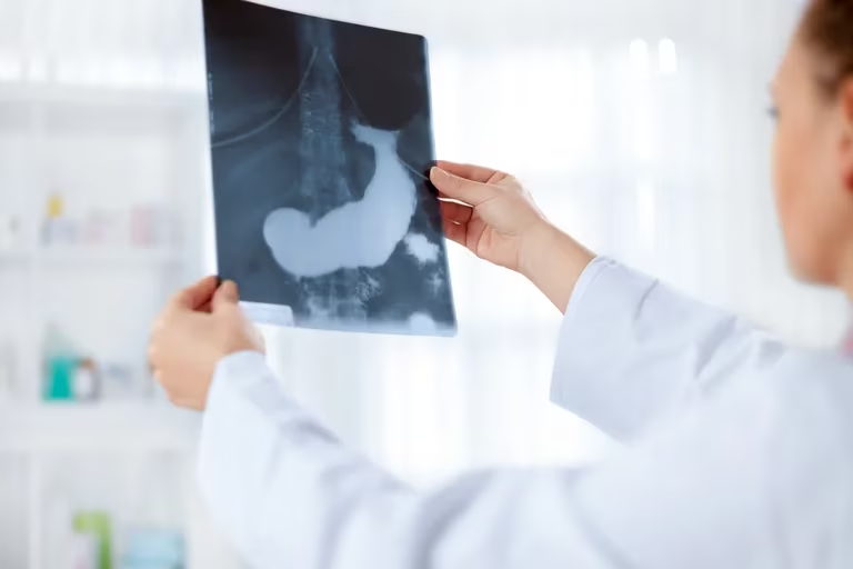 Cuáles son los dos nuevos síntomas tempranos del cáncer de páncreas Cuáles son los dos nuevos síntomas tempranos del cáncer de páncreas