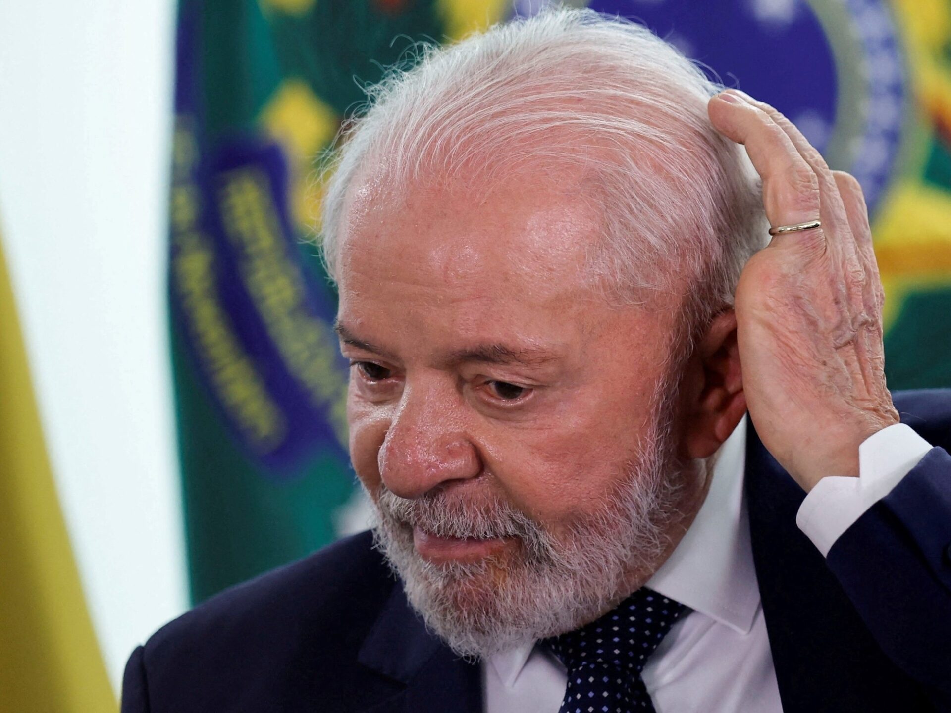 Lula fue operado de urgencia por una hemorragia intracraneal