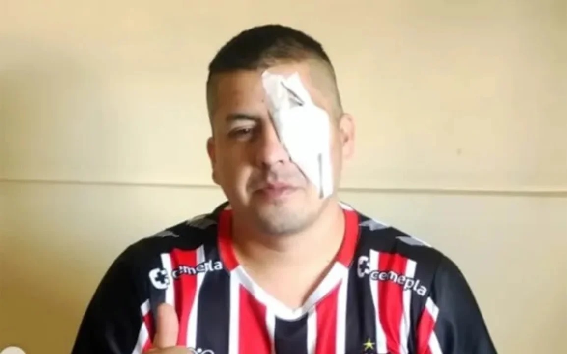 Un hincha de Chacarita denunció a Bullrich tras perder un ojo en los disturbios en el Congreso