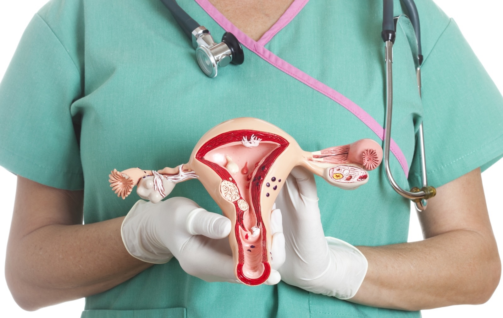 26 de marzo, Día Mundial del Cáncer de Cuello Uterino