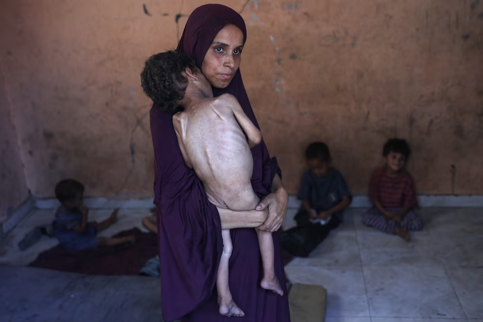 La hambruna en Gaza, contada por una enfermera en primera línea: “Cada semana los números son mayores”